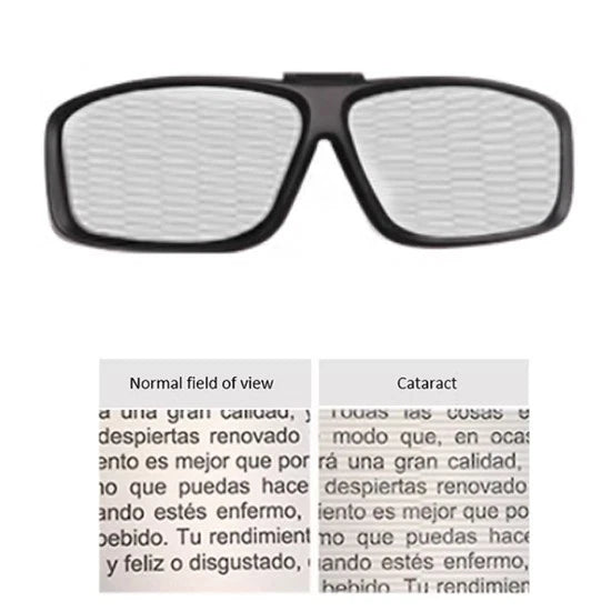 Senior Old Aged Eye Diseases Simulator (Cataract)
