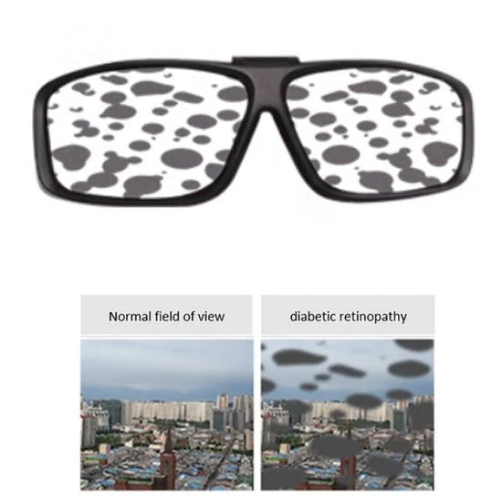 Senior Old Aged Eye Diseases Simulator (Diabetic Retinopathy)