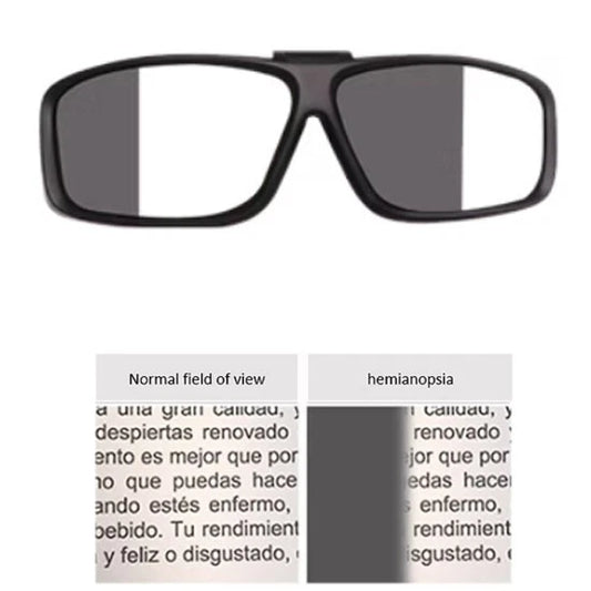 Senior Old Aged Eye Diseases Simulator (Hemianopsia)